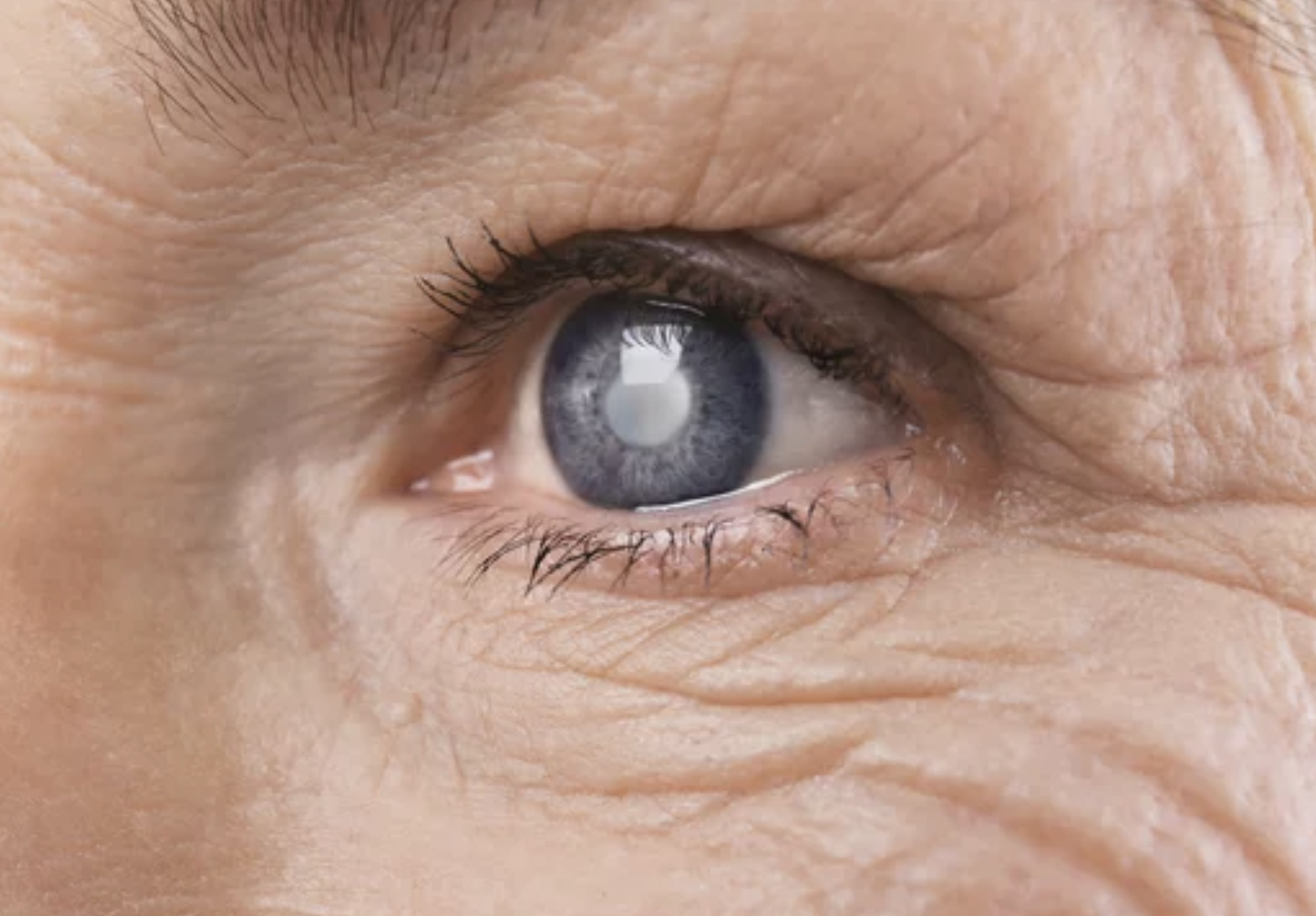 Cataract Surgery in Harley Street London